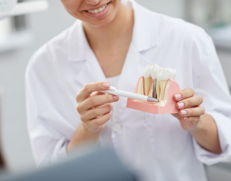 dentist-explaining-tooth-implantation-process-W4PZYA8