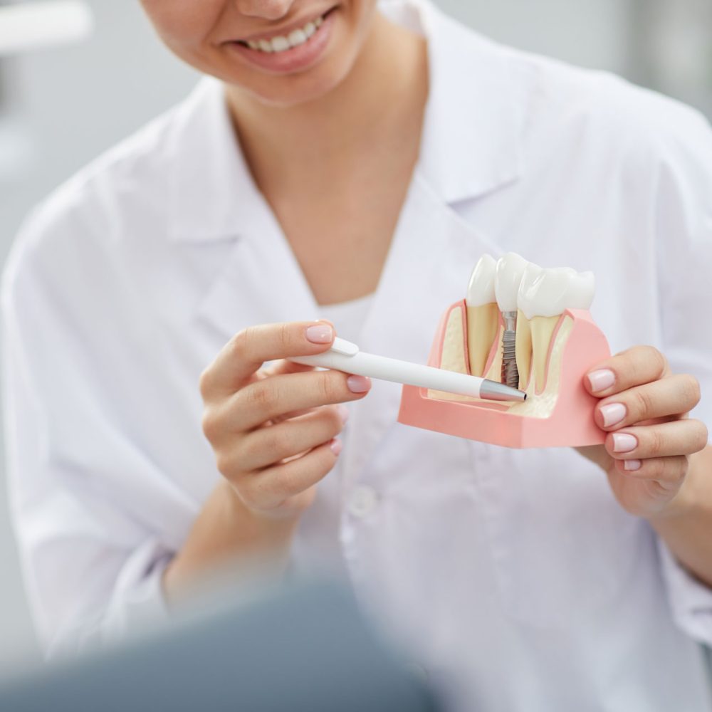 dentist-explaining-tooth-implantation-process-W4PZYA8